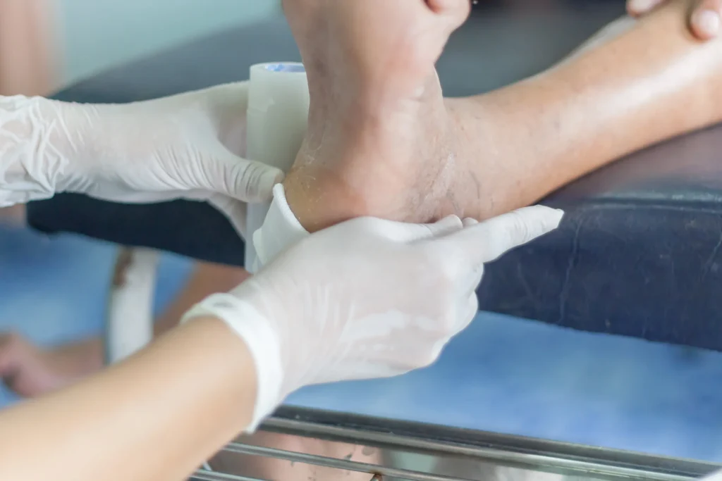 Wound Care and Limb Salvage Surgery